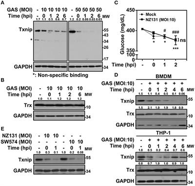 HECT E3 Ubiquitin Ligase-Regulated Txnip Degradation Facilitates TLR2-Mediated Inflammation During Group A Streptococcal Infection